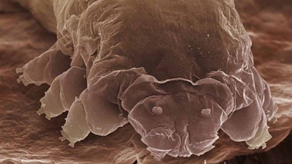 Невидимые соседи — дерматолог рассказала, кто живёт на нашей коже