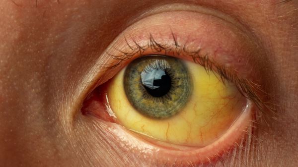 Застой желчи: модный диагноз или реальная проблема