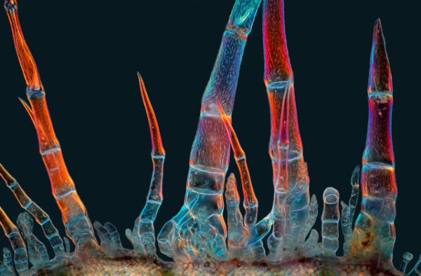Поразительные снимки-победители конкурса микрофотографии Nikon Small World 2025 (20 фото)