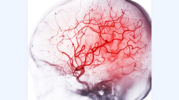 Врач перечислила 5 способов улучшить мозговое кровообращение