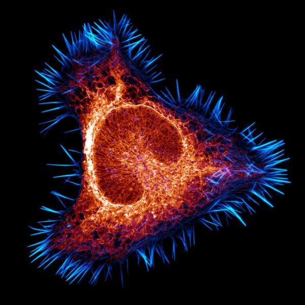Поразительные снимки-победители конкурса микрофотографии Nikon Small World 2025 (20 фото)