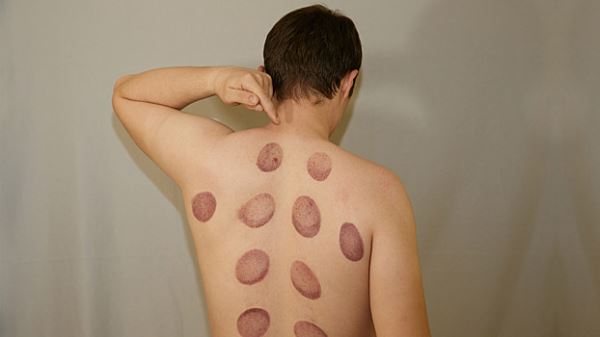 Методы лечения из прошлого, которые нужно забыть