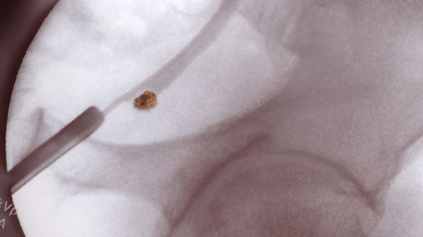 Врач рассказала, к чему может привести избыток витаминов