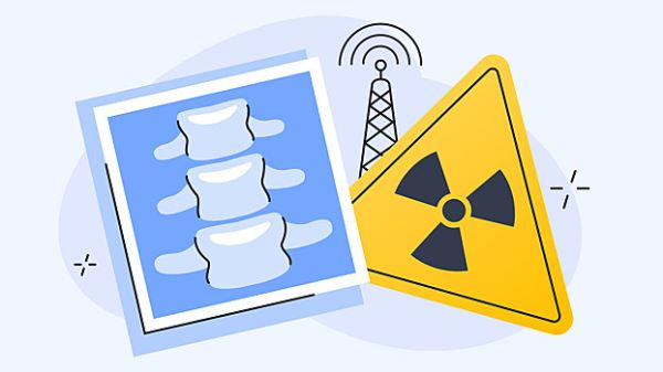 Радиация вокруг нас: как мы облучаемся дома, в больнице и на улице