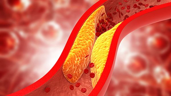 Учёные научились снижать холестерин без диет и&nbsp;статинов