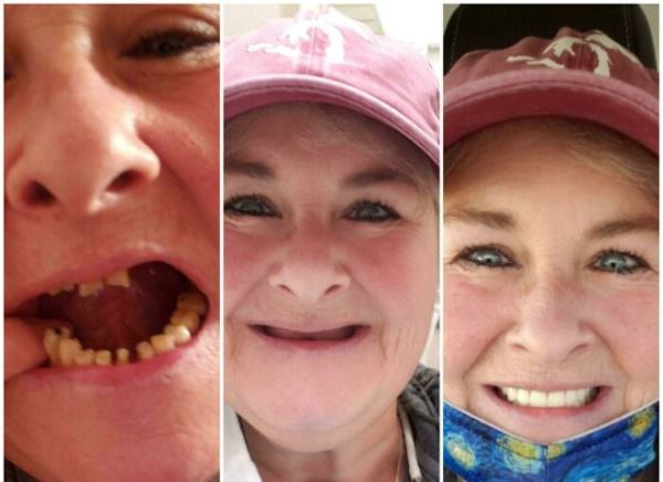 Впечатляющие преображения, которые вызовут улыбку (20 фото)