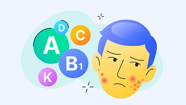 Осенний авитаминоз: диагноз из рекламы или реальная проблема